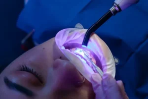 Why Patients Choose Simply Teeth for Cosmetic and General Dentistry